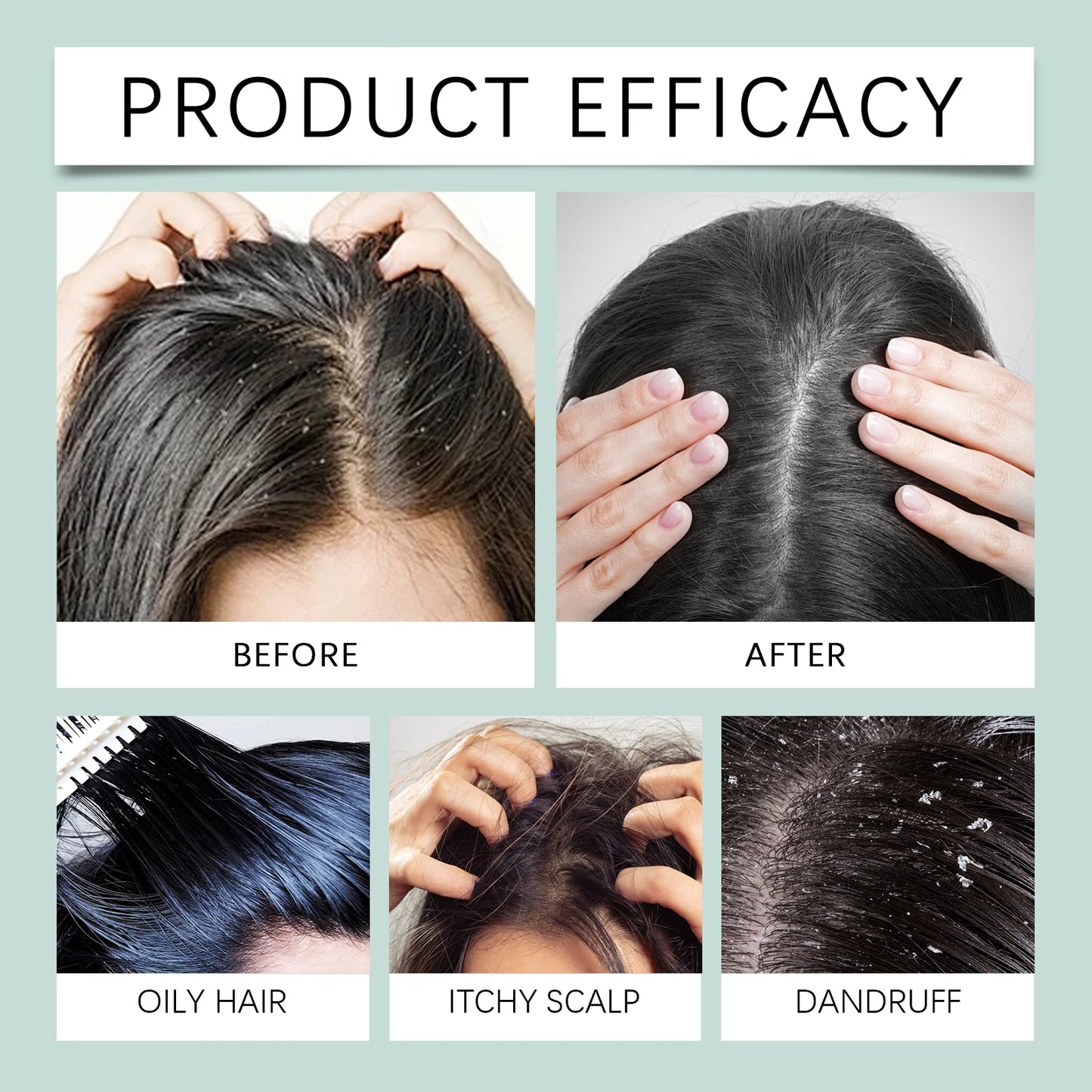 Scalp Scrub Exfoliator With Massage Brush Peppermint Rosemary & Sea Salt For Oil Control Dandruff Deep Cleansing Refreshing Set